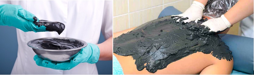 С 01.12.2025 парафино-озокеритовые аппликации и грязе-лечение временно не работают.